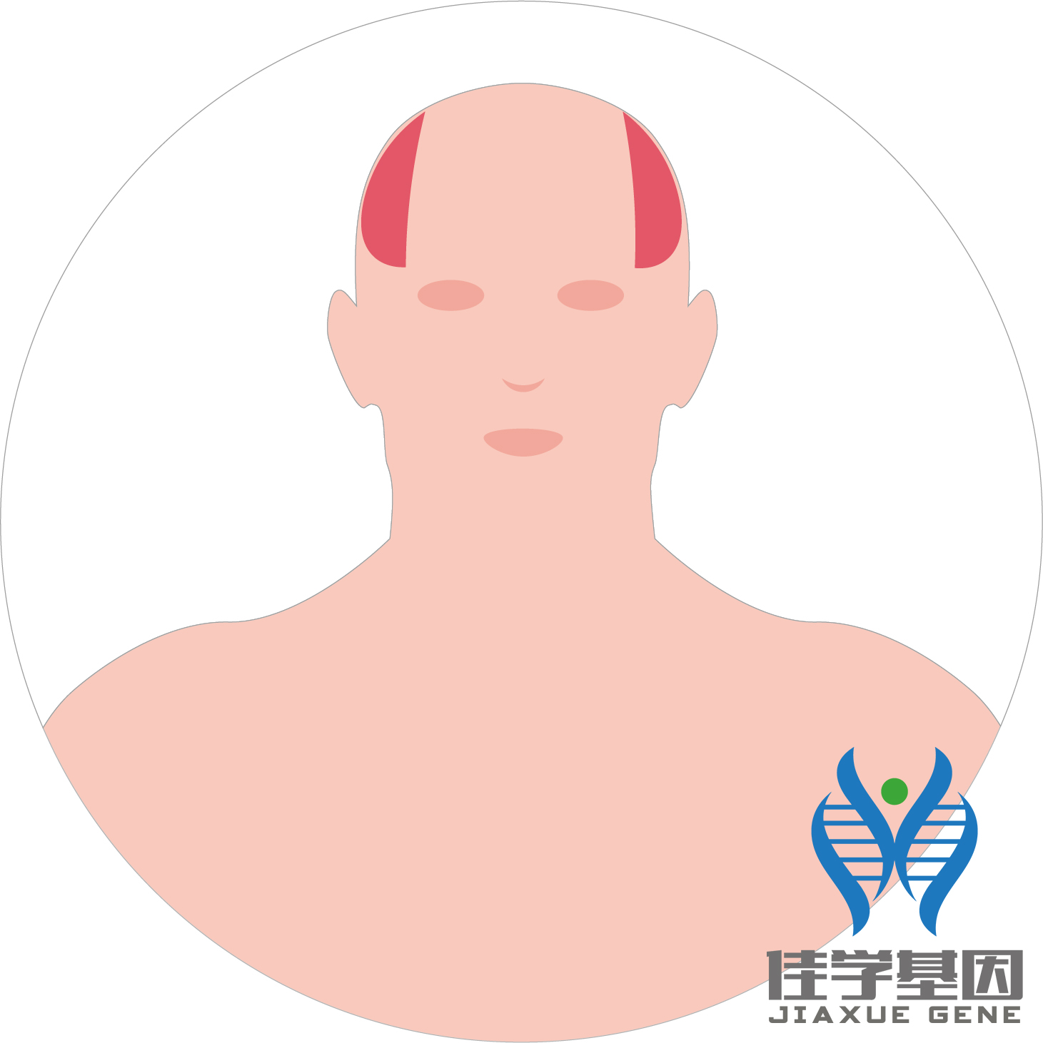 【佳學(xué)基因檢測(cè)】男性<font color='red'>脫發(fā)</font>（Androgenetic alopecia）基因解碼、<a href=http://floridacomunitycollege.com/tk/jiema/cexujishu/2021/31933.html>基因檢測(cè)</a>